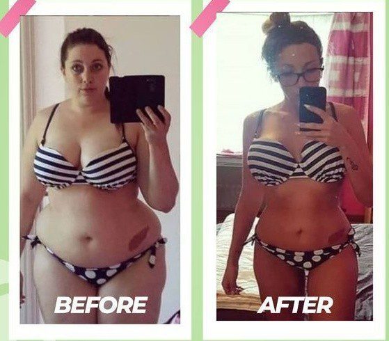 exipure weight loss before and after