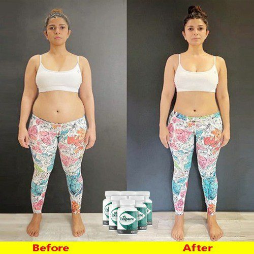 exipure before and after weight loss
